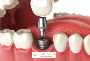 Implante Dentário Dói?