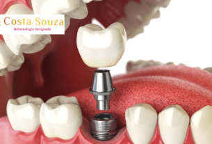 Implante dentário em Icaraí