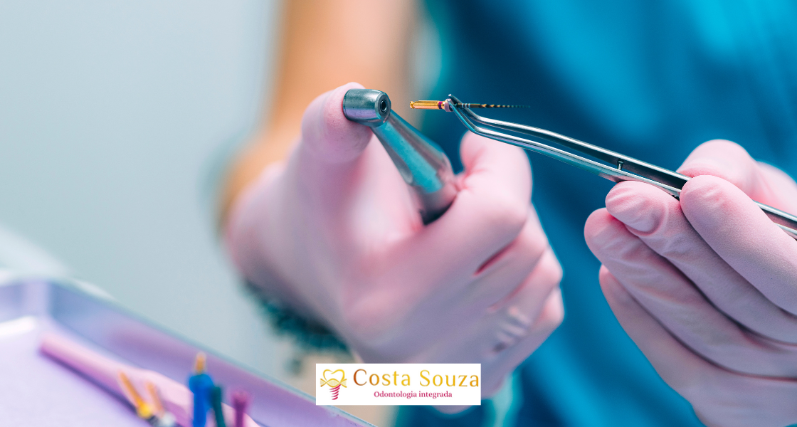 Tratamento de Endodontia