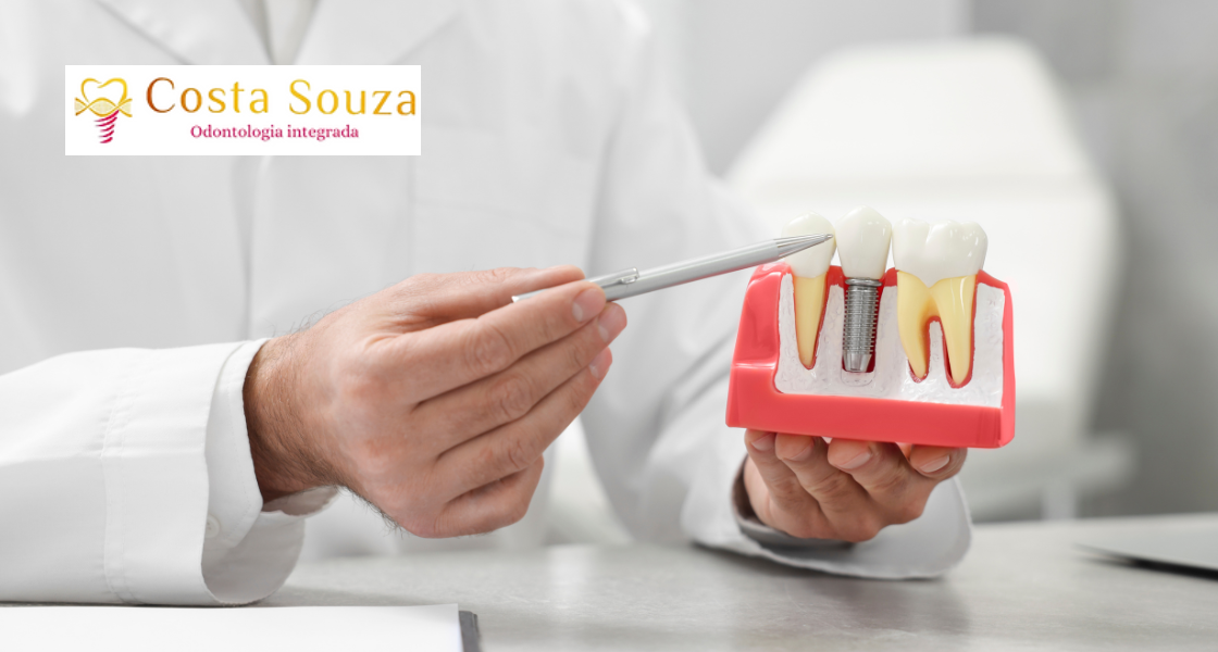 Implante Dentário em Piratininga