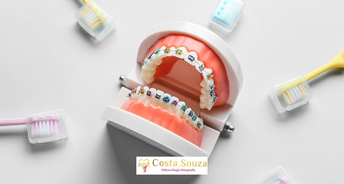 Dentes Tortos