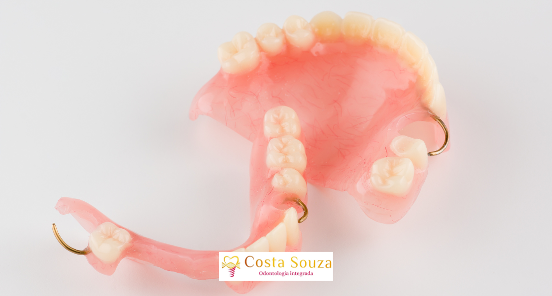 Perdeu um Dente